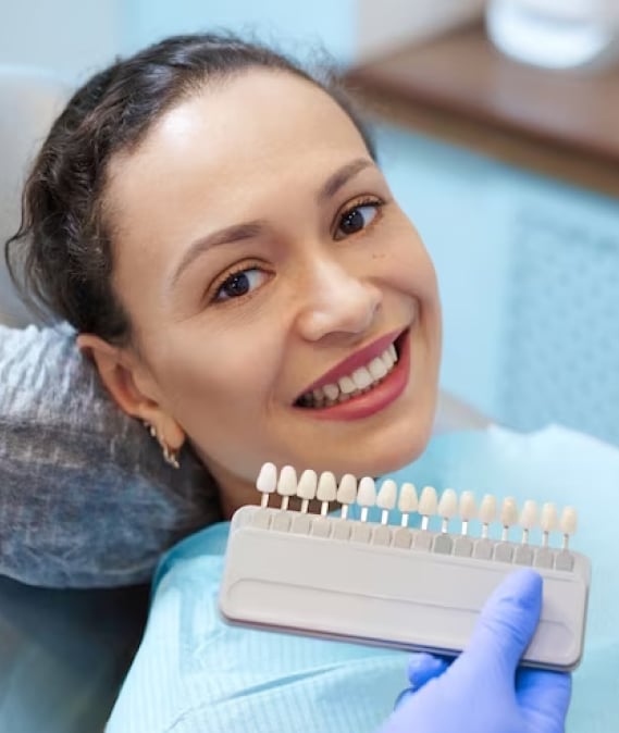composite veneers in san antonio