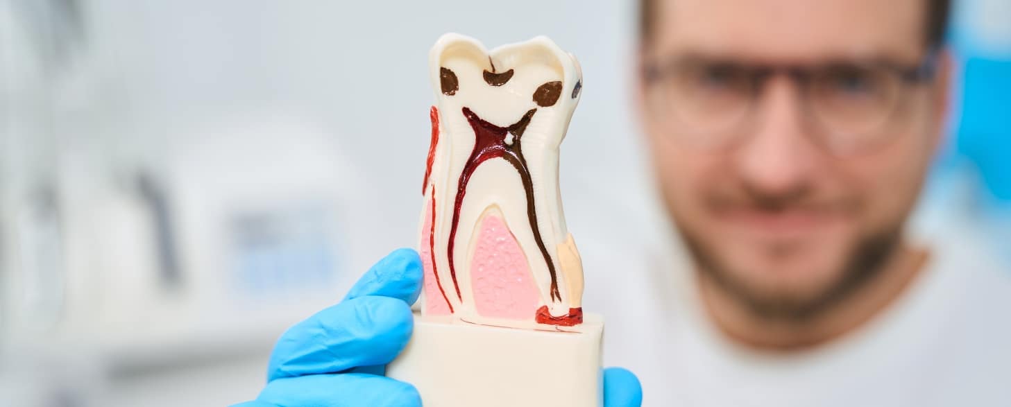 do root canals impact your ongoing health problems