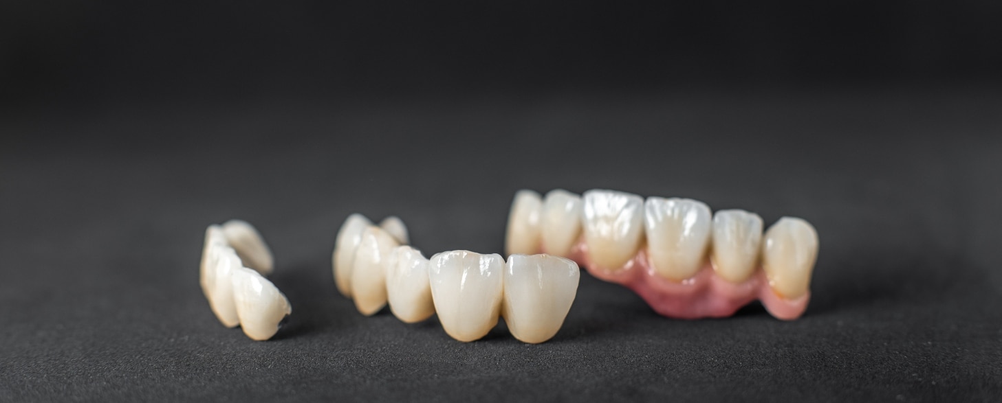 how to take care of a new dental crown: a comprehensive guide