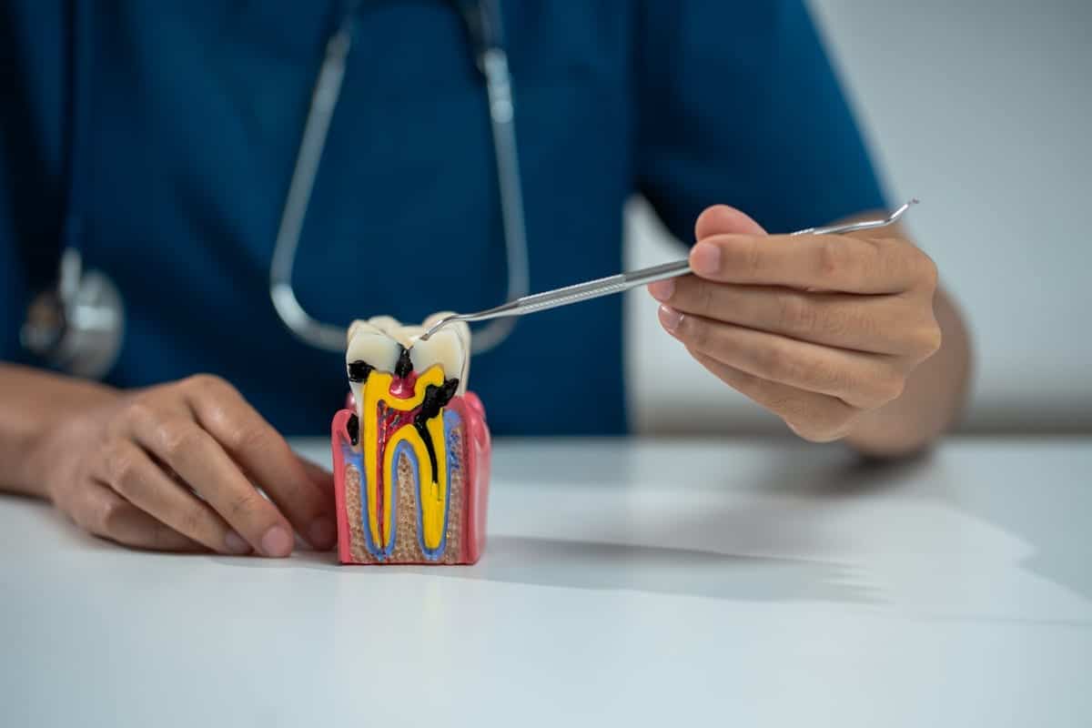 Root Canal Treatment in San Antonio