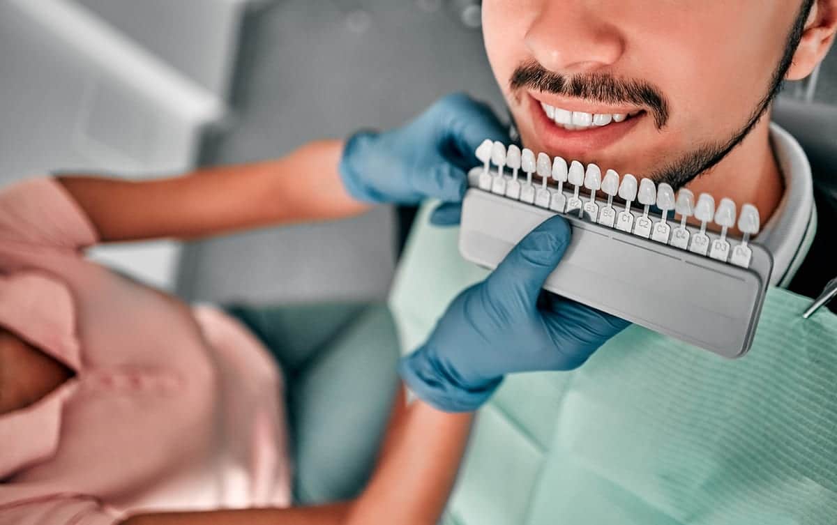Veneers in San Antonio